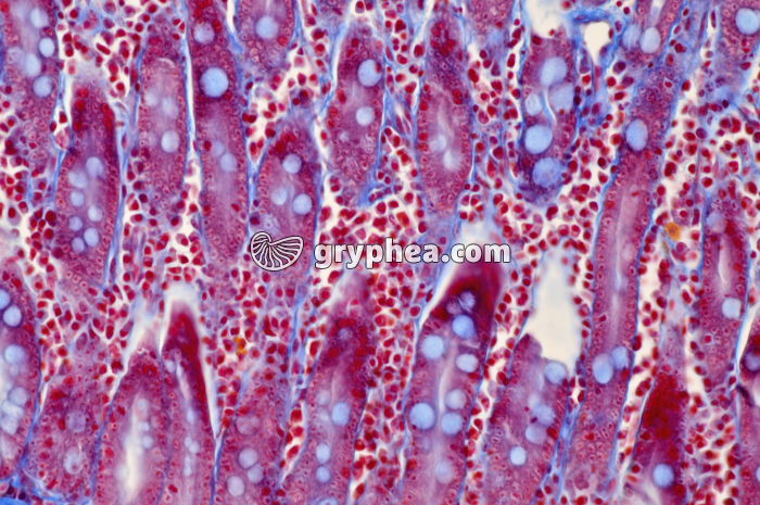 Duodenum x100 - gryphea.org